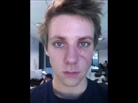 Redovno je slikao selfije lica, a onda je jednog dana nastradao! 