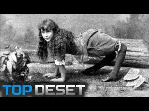 Ovi su ljudi pretvoreni u atrakcije zbog nevjerojatnih tjelesnih deformacija