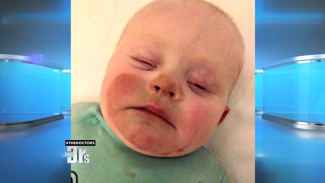 VIDEO Bebi se nakon dojenja pojavila čudna promjena na koži za koju postoji vrlo glupo objašnjenje