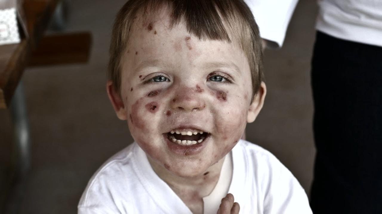 VIDEO Odmah nakon poroda su uočili problem, ni vlastiti roditelji ga ne smiju zagrliti