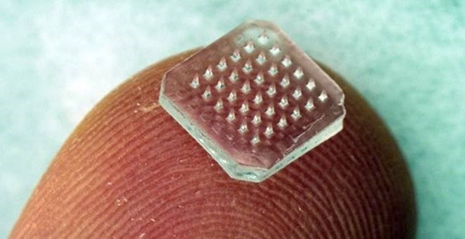 Zaboravite igle, ovo je budućnost "pikanja"