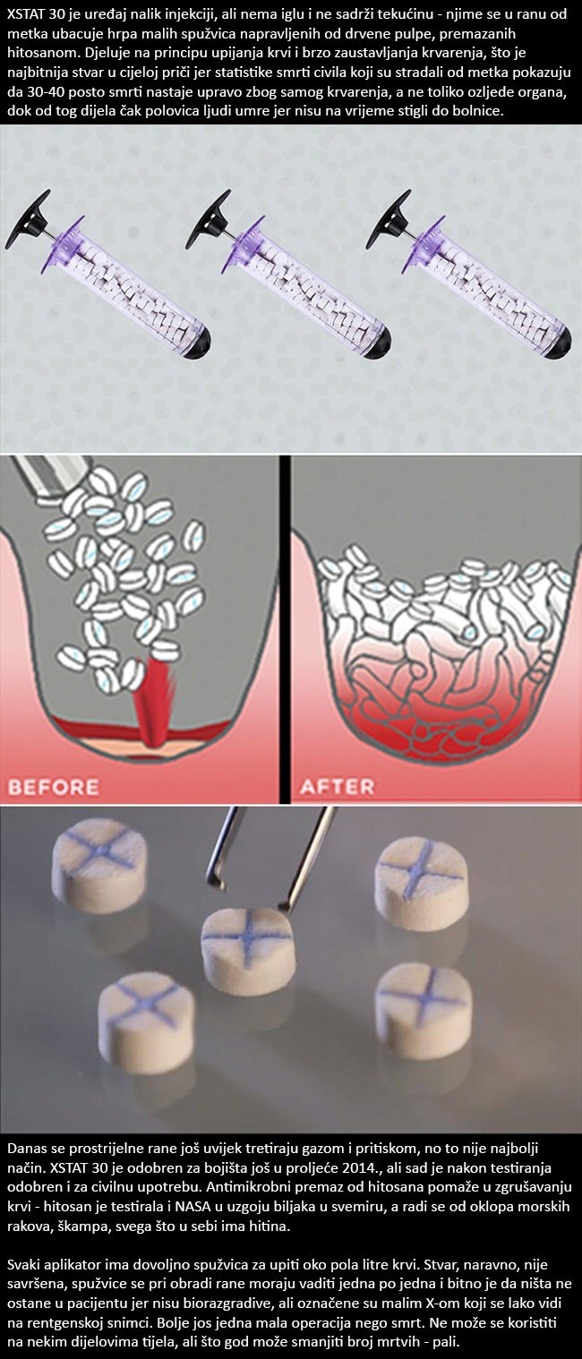 Ovaj genijalni izum spašava živote žrtvama pucnjave u manje od minute!