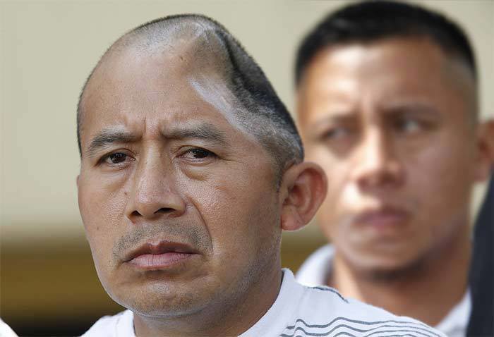 Preživio s bez gotovo pola mozga!