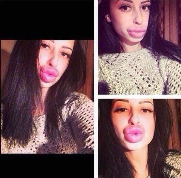 Htjela "superduckface", postala grdobina