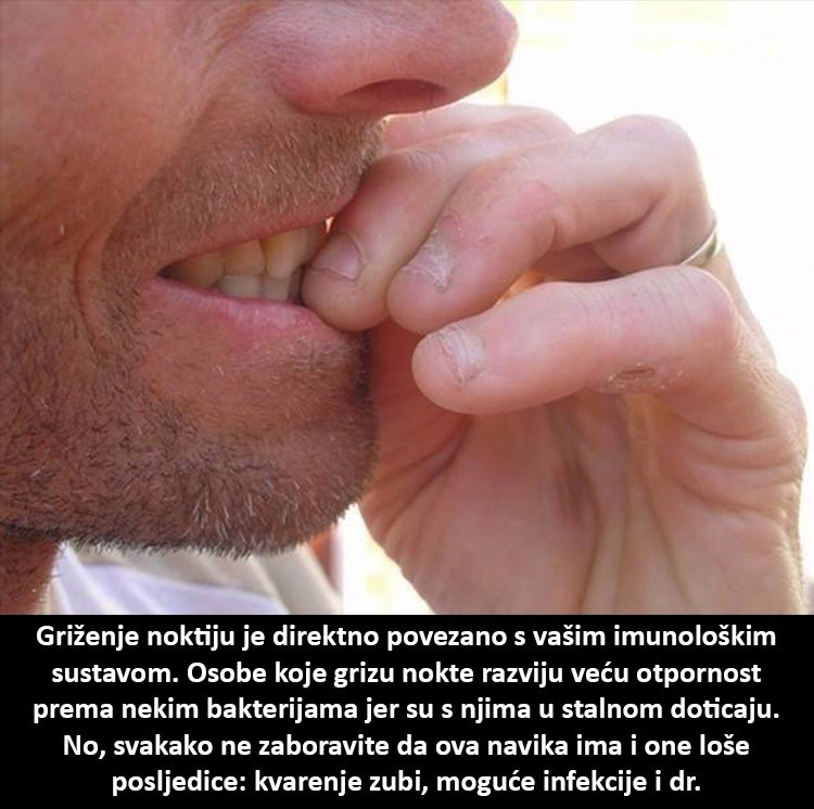 Grizete nokte? Evo jedna mala utjeha za vas!