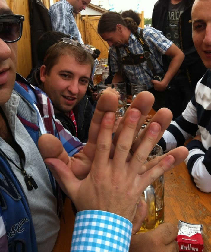 S ovakvim ručerdama u kamenolomu radiš samo šakama