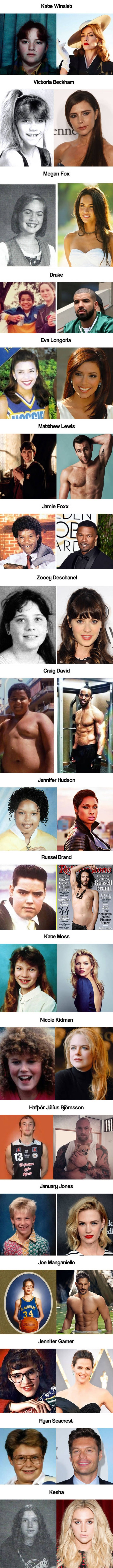 Koja razlika! Ovako su poznate zvijezde izgledale prije nego što su postale bogate i slavne