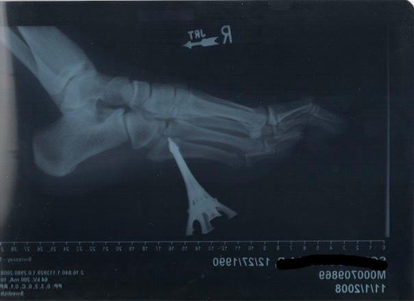 Ni u ludilu nemoj kročiti nogom na Eiffelov toranj!