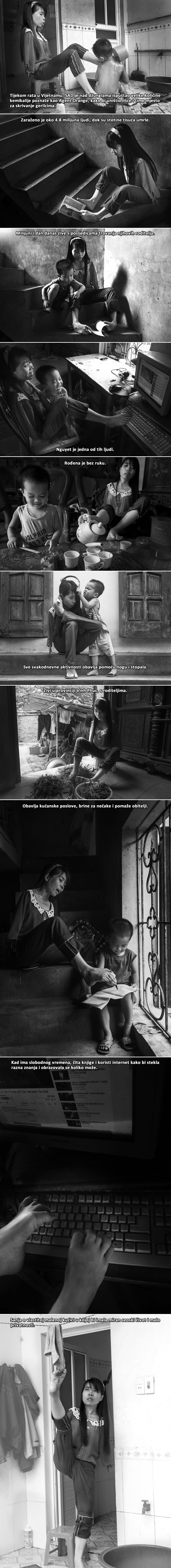 GALERIJA: Posljedice američkog genocida u Vijetnamu nisu porazile ovu hrabru djevojku!