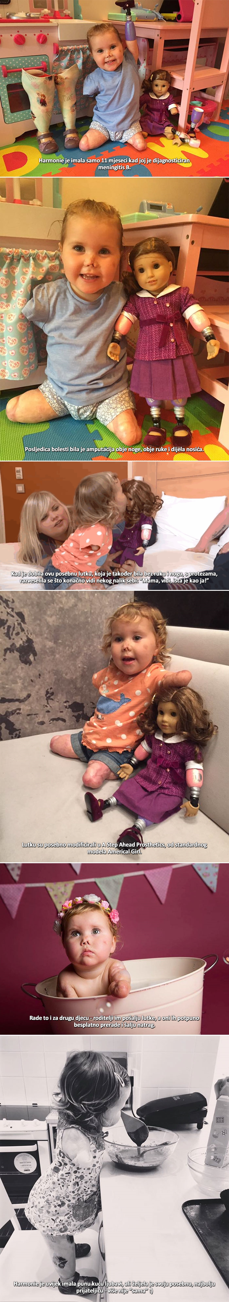 Dvogodišnja djevojčica bez ruku i nogu sretna do neba zbog lutke koja izgleda baš poput nje