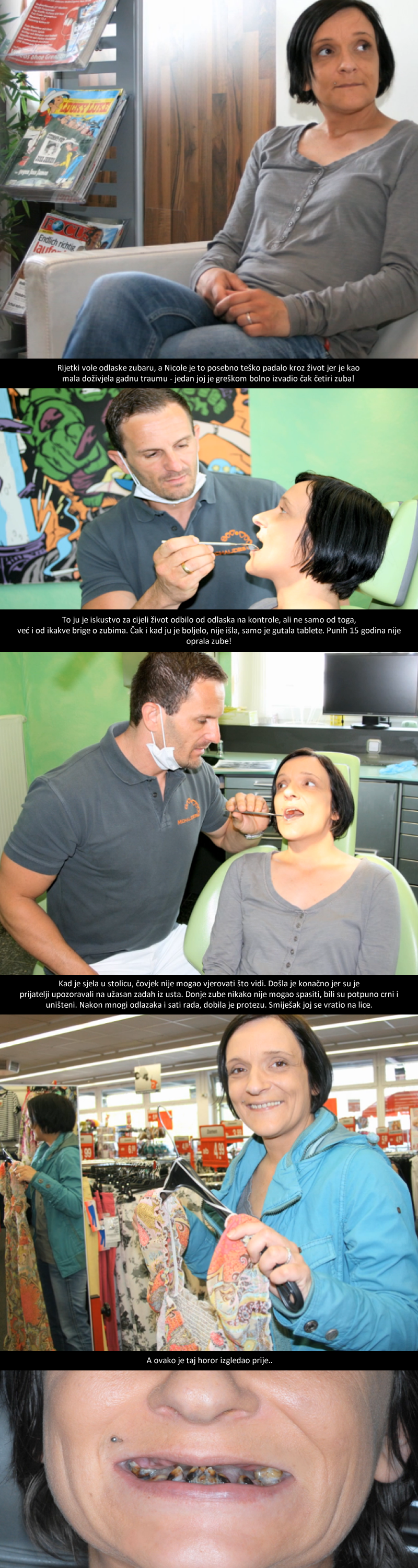 ZUBAR U ŠOKU: Ova žena nije prala zube 15 godina, pogledajte na što liči!