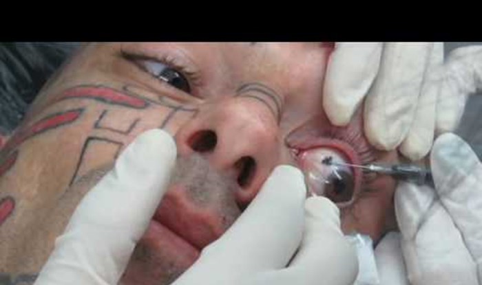 Pogledajte kako izgleda tetoviranje bjeloočnice 