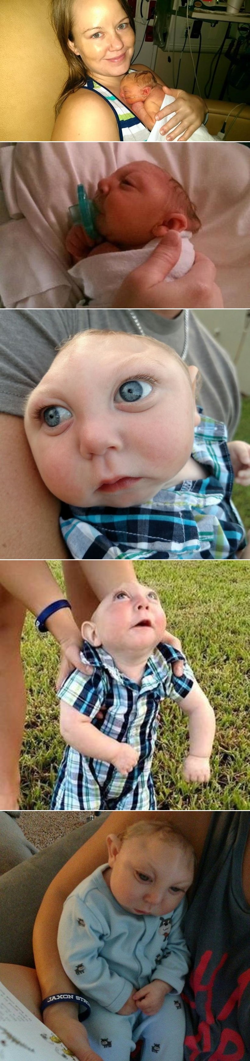 GALERIJA: Rođenje djeteta koje je podijelilo svijet