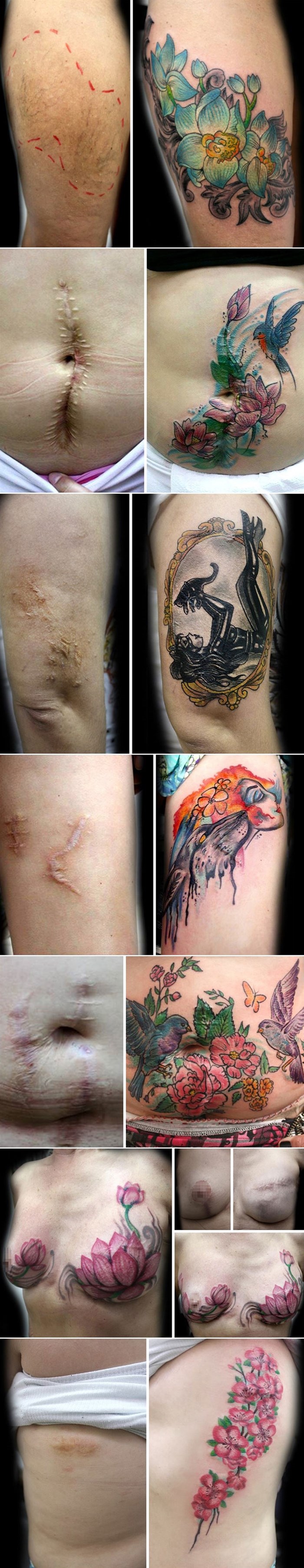 Ova tattoo majstorica poklanja tetovaže zlostavljanim ili ženama oboljelim od raka