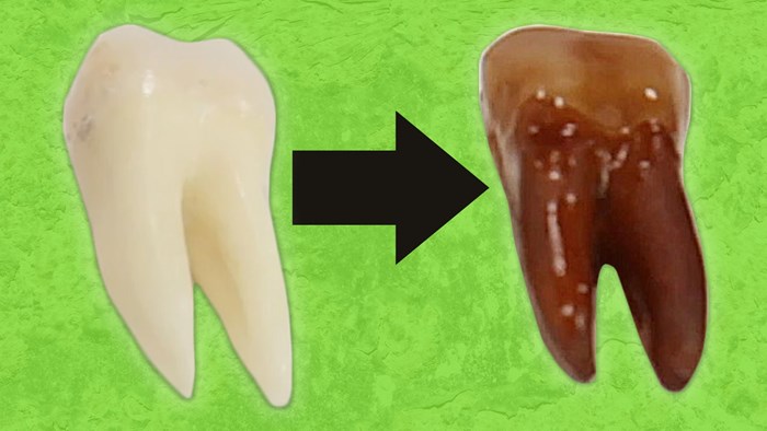 VIDEO: Što se događa s vašim zubima kad pijete gazirana pića!
