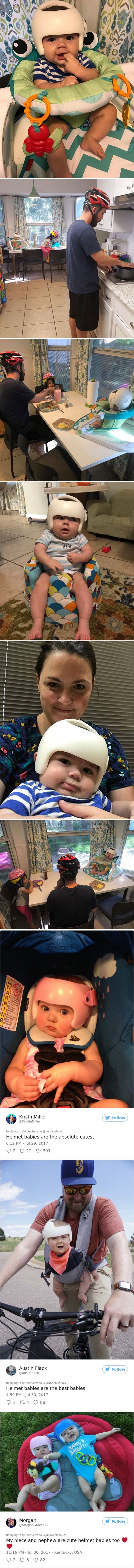 Beba je morala nositi kacigu na glavi pa joj se pridružila cijela obitelj i osvojila srca tisuća ljudi