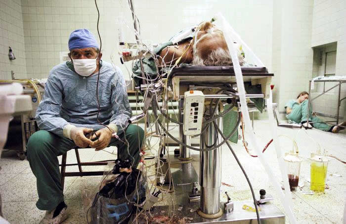 Iscrpljeni kirurg spasio život: Transplantacija srca