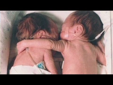 VIDEO: Medicinska sestra prekršila pravila i pomogla pobijediti smrt bebice!