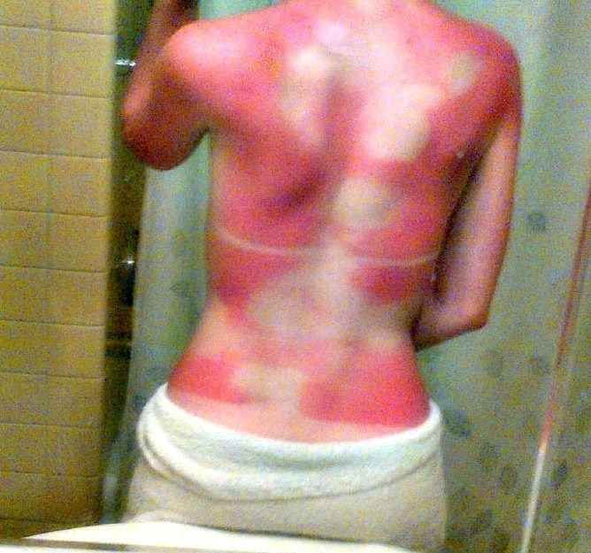 Auch, ovo boli i od gledanja!