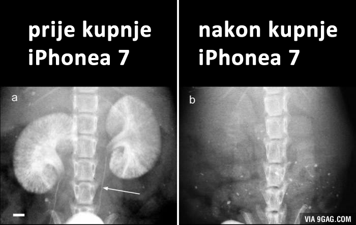 Prije i nakon kupnje iPhonea 7