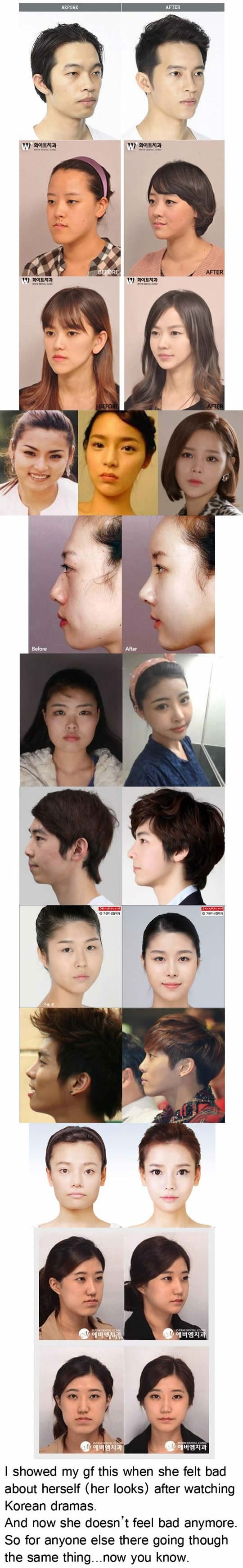 Korejci si povećavaju oči: Navala na plastične operacije