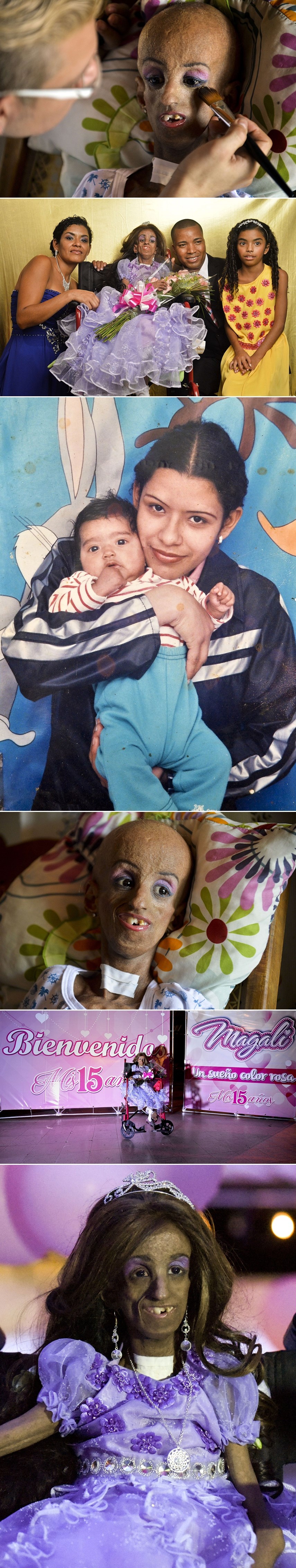 Djevojčica zarobljena u tijelu 90-godišnjakinje doživjela ostvarenje svog sna i pobijedila prognoze!