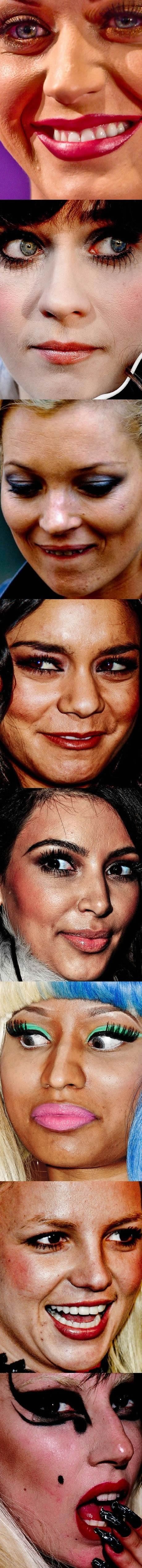 Celebrity zvjezdice u krupnom planu - nije za slabi želudac