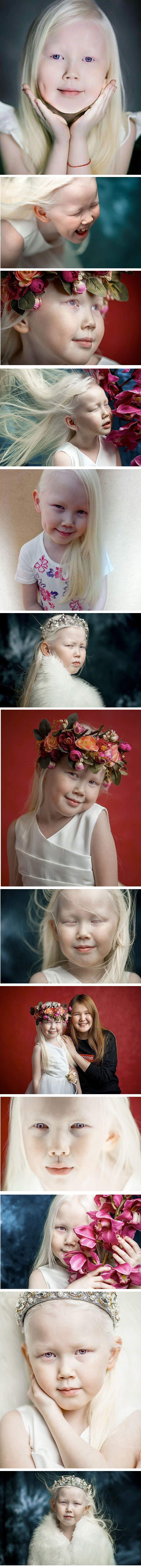Osmogodišnja albino djevojčica svojom je ljepotom očarala brojne modene agancije