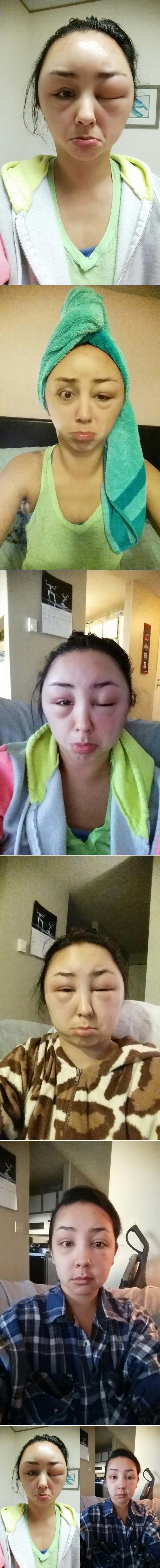 ŽENI SKORO EKSPLODIRALA GLAVA: Otišla na frizuru, umalo umrla!