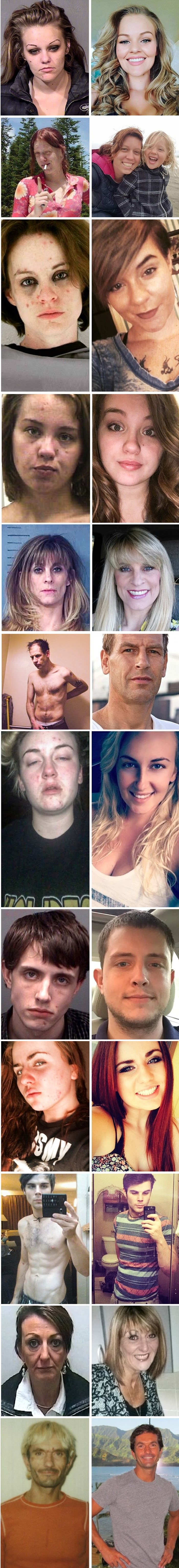 Čudesne transformacije - Pogledajte kako ovi ljudi izgledaju nakon što su prestali konzumirati drogu