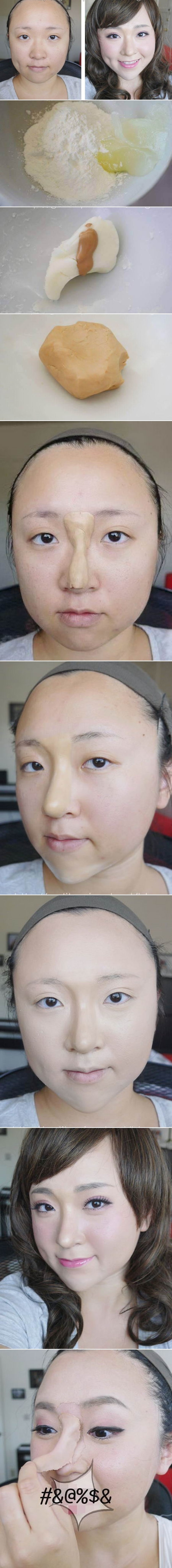 GALERIJA: Plastična operacija iz kućne radinosti