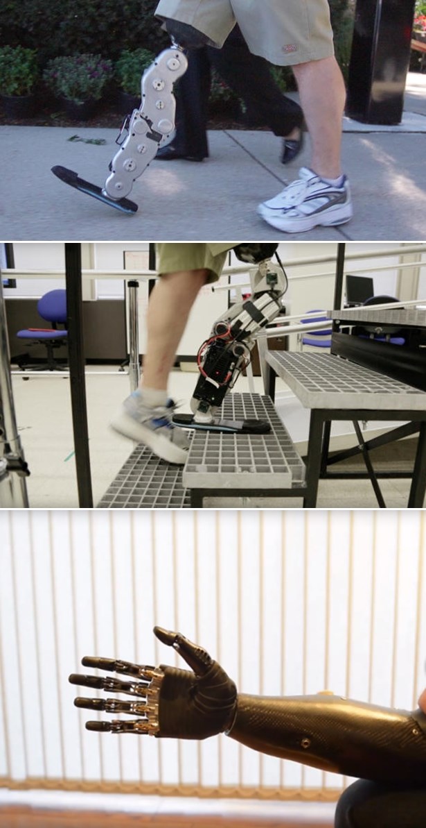 Upoznajte prvi umjetni ud pokretan mislima