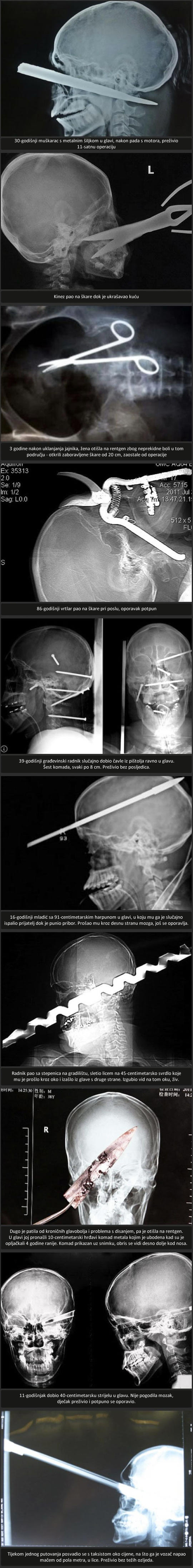 Najstravičnije rentgenske snimke nesreća