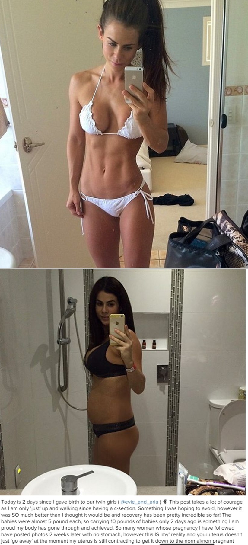 GALERIJA: Zapanjila svijet tijelom samo dva dana nakon poroda