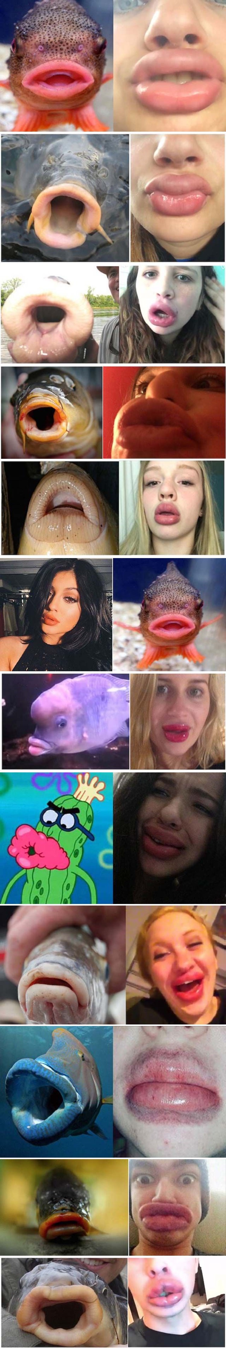 Netko se brutalno narugao ženama koje su pretjerale s operacijama usana, evo s čim ih je usporedio!