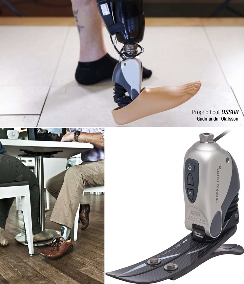 Budućnost je stigla: Prva prava bionička proteza pokretana mislima