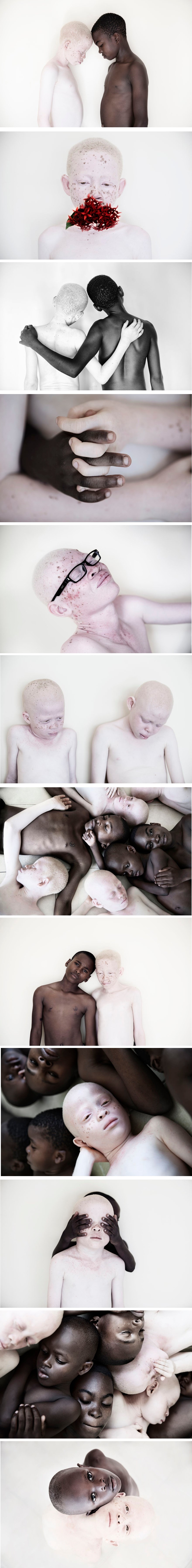 Fotografirala je albino djecu kako bi osvijestila ljude o problemu kroz koji prolaze u Tanzaniji 