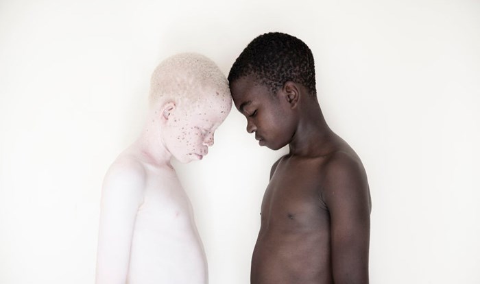 Fotografirala je albino djecu kako bi osvijestila ljude o problemu kroz koji prolaze u Tanzaniji 