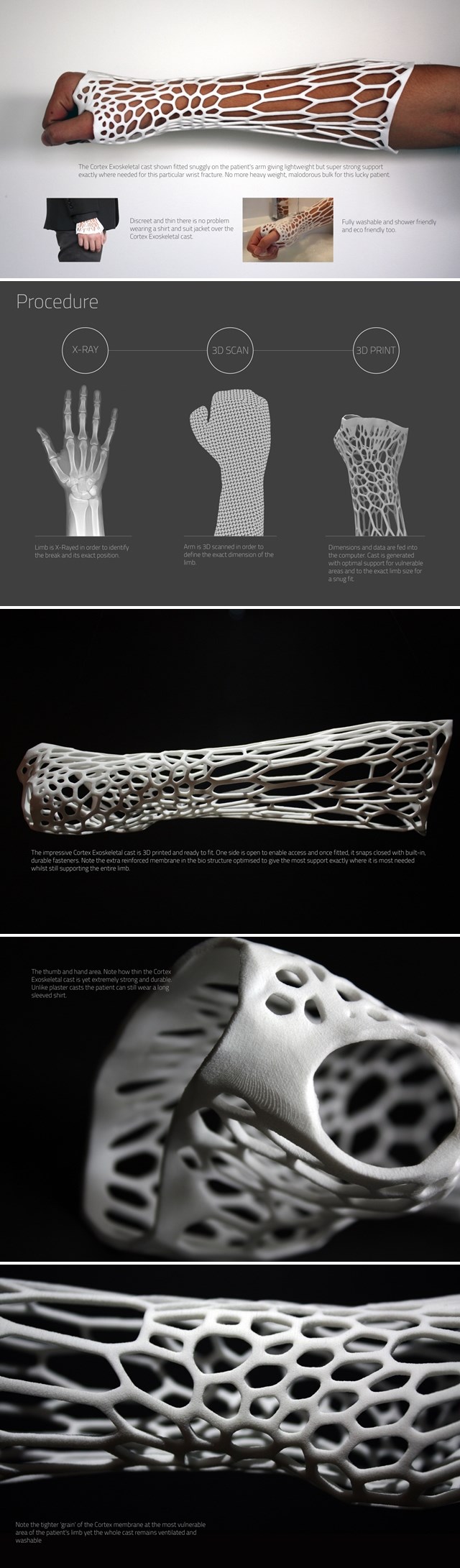 3D printani gips je budućnost