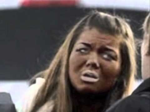 BESMISLENI TREND Ne pretjerujte sa sunčanjem kako ne biste završili kao ove osobe!