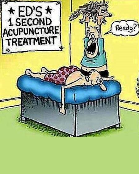 Ekspresna akupunktura - gotovo u sekundi