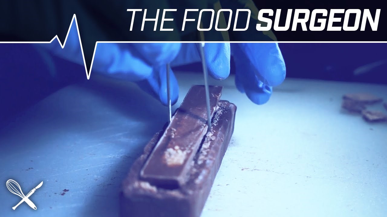 KIRURG ZA HRANU izveo riskantnu operaciju - presadio čokoladicu!