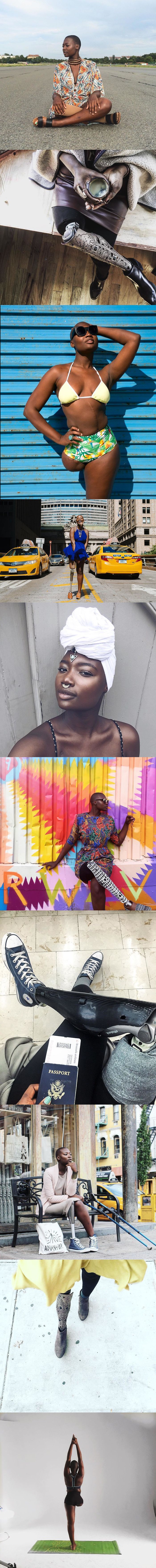 Ova je djevojka ostala bez noge, no to je nije spriječilo u ostvarenju njezinih snova