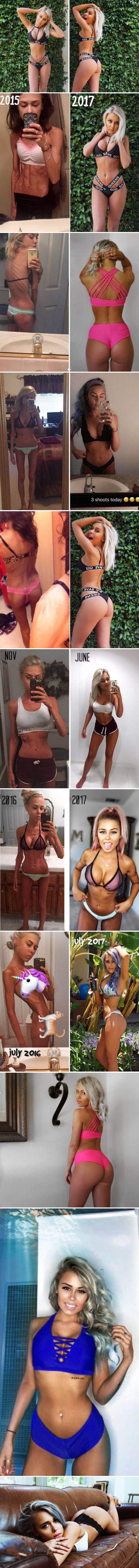 Shvatila je da kostur kojeg vidi u ogledalu nije zgodan, evo rezultata njene borbe protiv anoreksije