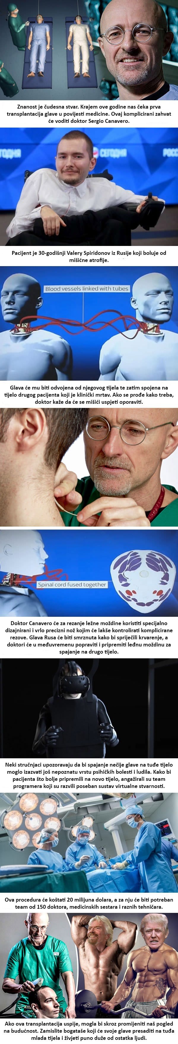 Krajem godine će se izvesti prva transplantacija glave u povijesti koja bi mogla promijeniti našu budućnost!