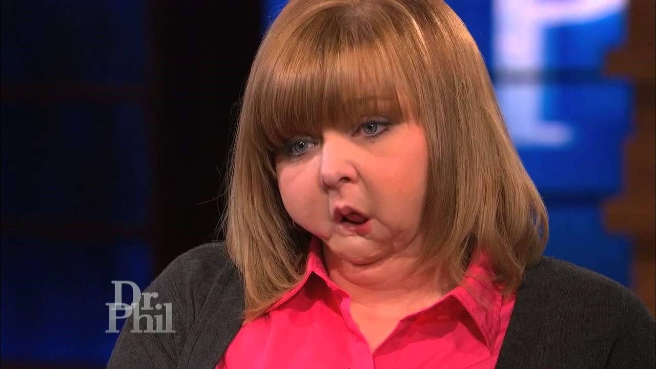 VIDEO Uživo na televiziji je upoznala ženu koja ju je kao dijete upucala u lice, evo kako su reagirale