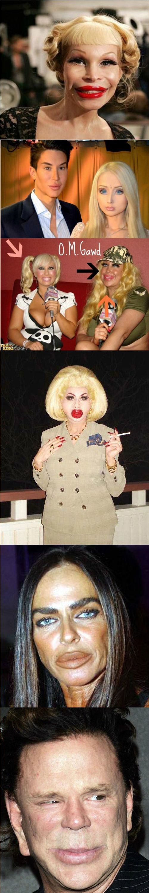 Ovi su ljudi pretjerali s estetskim operacijama i potpuno izobličili svoje lice