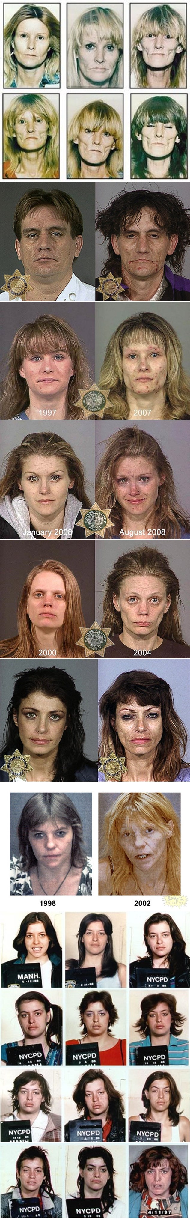 Droga nije odgovor, droga je pakao dok si još živa