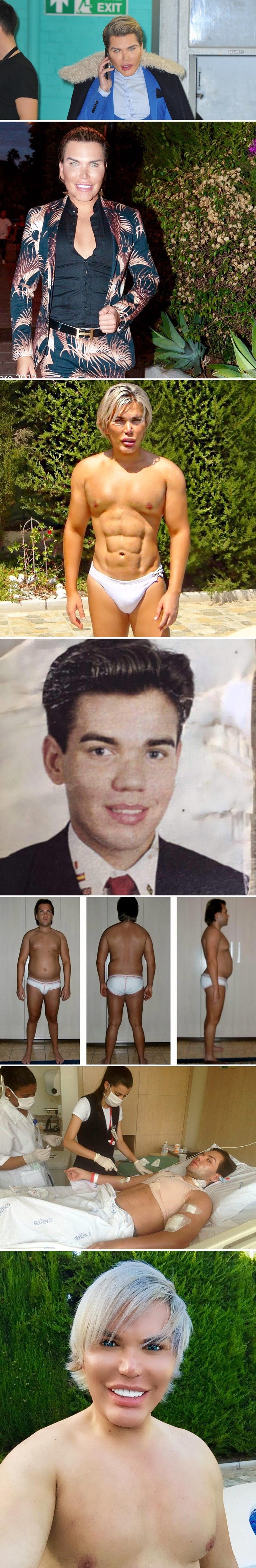 Ljudski lutak Ken je konačno otkrio kako je izgledao prije svoje prve estetske operacije