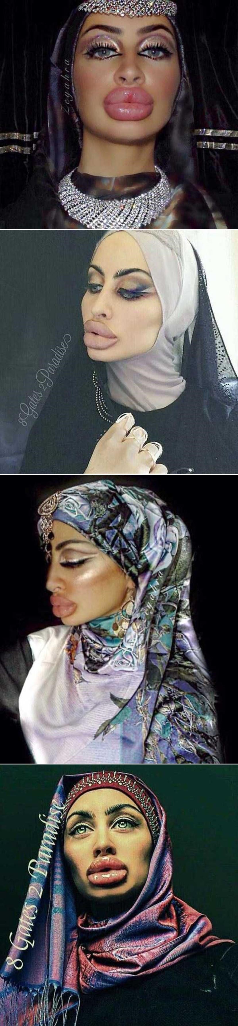 SIŠE AUSPUHE: Najveće silikonjare Afganistana haraju Instagramom